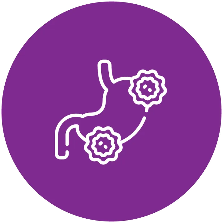 Stomach Cancer
